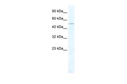 Antibody used in WB on Human Jurkat cells at 2.5 ug/ml.