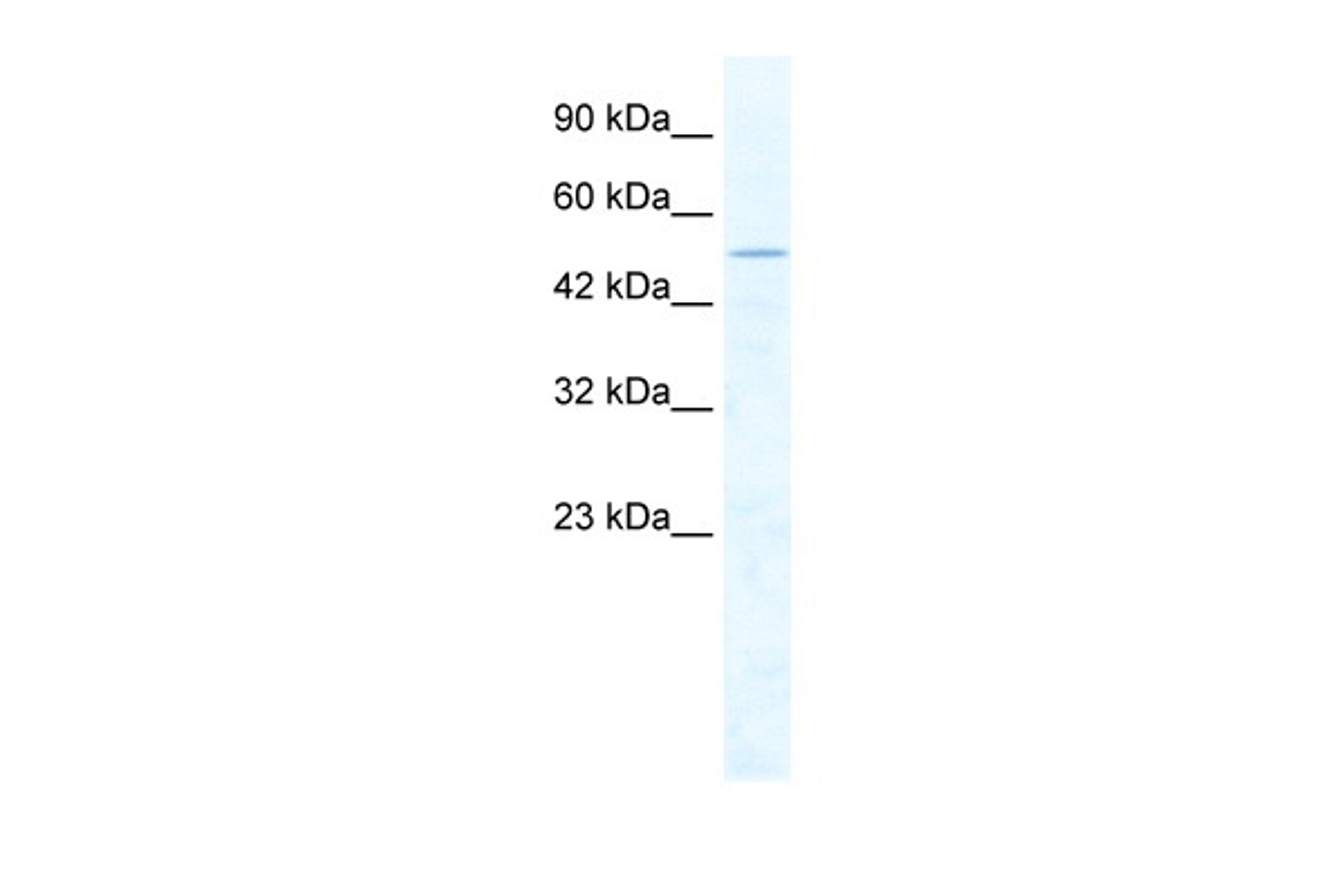 Antibody used in WB on Human Jurkat cells at 2.5 ug/ml.