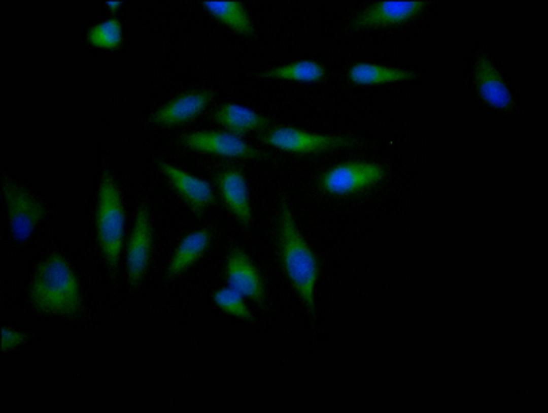 Immunofluorescence staining of Hela Cells with CSB-RA797631A0HU at 1:50, counter-stained with DAPI. The cells were fixed in 4% formaldehyde, permeated by 0.2% TritonX-100, and blocked in 10% normal Goat Serum. The cells were then incubated with the antibody overnight at 4℃. Nuclear DNA was labeled in blue with DAPI. The secondary antibody was FITC-conjugated AffiniPure Goat Anti-Rabbit IgG (H+L).