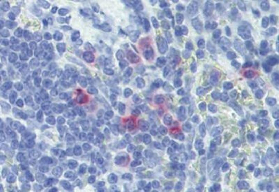 Immunohistochemistry-Paraffin: IL13 Antibody (A130D 12G5 1E4) [NBP1-52466] - Staining of rat spleen. Immunohistochemistry of formalin-fixed, paraffin-embedded tissue after heat-induced antigen retrieval. Antibody concentration 10 ug/ml.