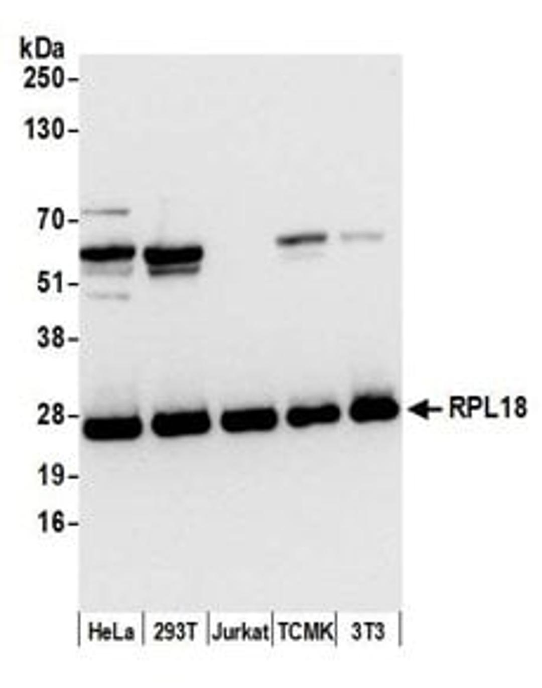 Detection of human and mouse RPL18 by western blot.