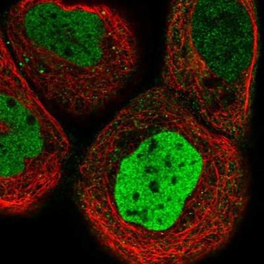 Immunocytochemistry/Immunofluorescence: MPHOSPH1 Antibody [NBP1-88042] - Staining of human cell line A-431 shows positivity in nucleus but not nucleoli.