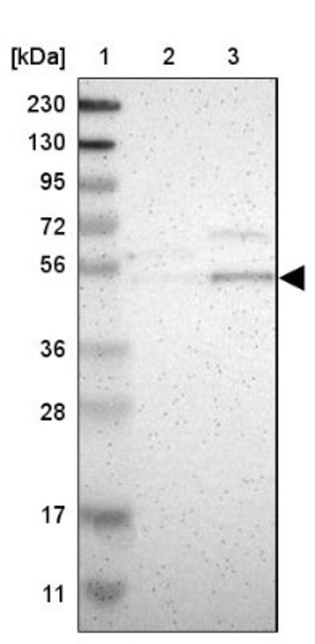 Western Blot: B4GALT1 Antibody [NBP1-88654] - Lane 1: Marker [kDa] 230, 130, 95, 72, 56, 36, 28, 17, 11<br/>Lane 2: Human cell line RT-4<br/>Lane 3: Human cell line U-251MG sp