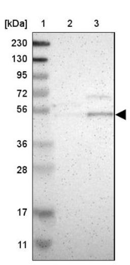 Western Blot: B4GALT1 Antibody [NBP1-88654] - Lane 1: Marker [kDa] 230, 130, 95, 72, 56, 36, 28, 17, 11<br/>Lane 2: Human cell line RT-4<br/>Lane 3: Human cell line U-251MG sp