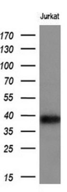 Western Blot: CD1c/BDCA-1 Antibody (2F4) [NBP2-46123] - Analysis of Jurkat extracts (10ug).