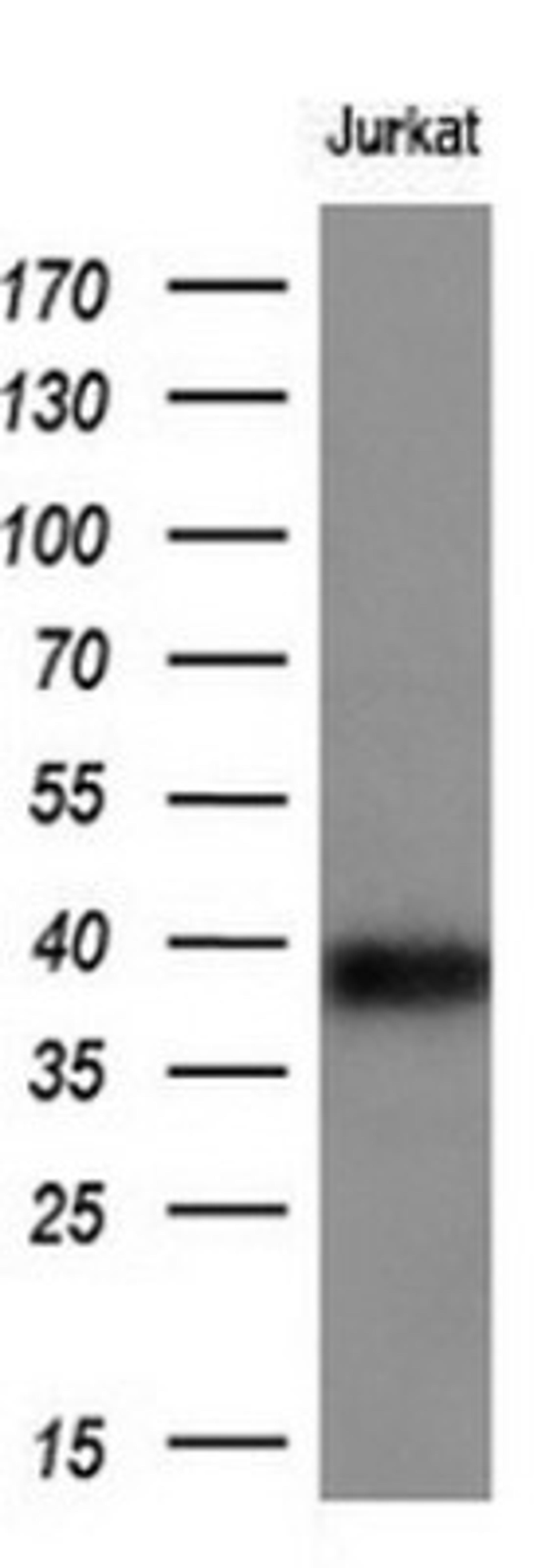 Western Blot: CD1c/BDCA-1 Antibody (2F4) [NBP2-46123] - Analysis of Jurkat extracts (10ug).