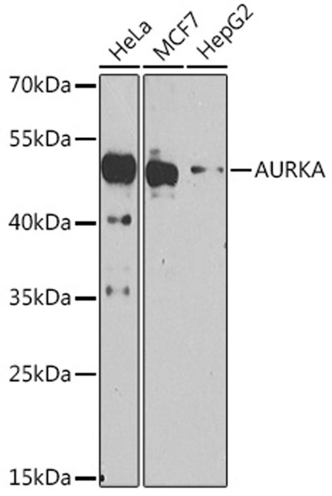 Western blot - AURKA antibody (A15728)