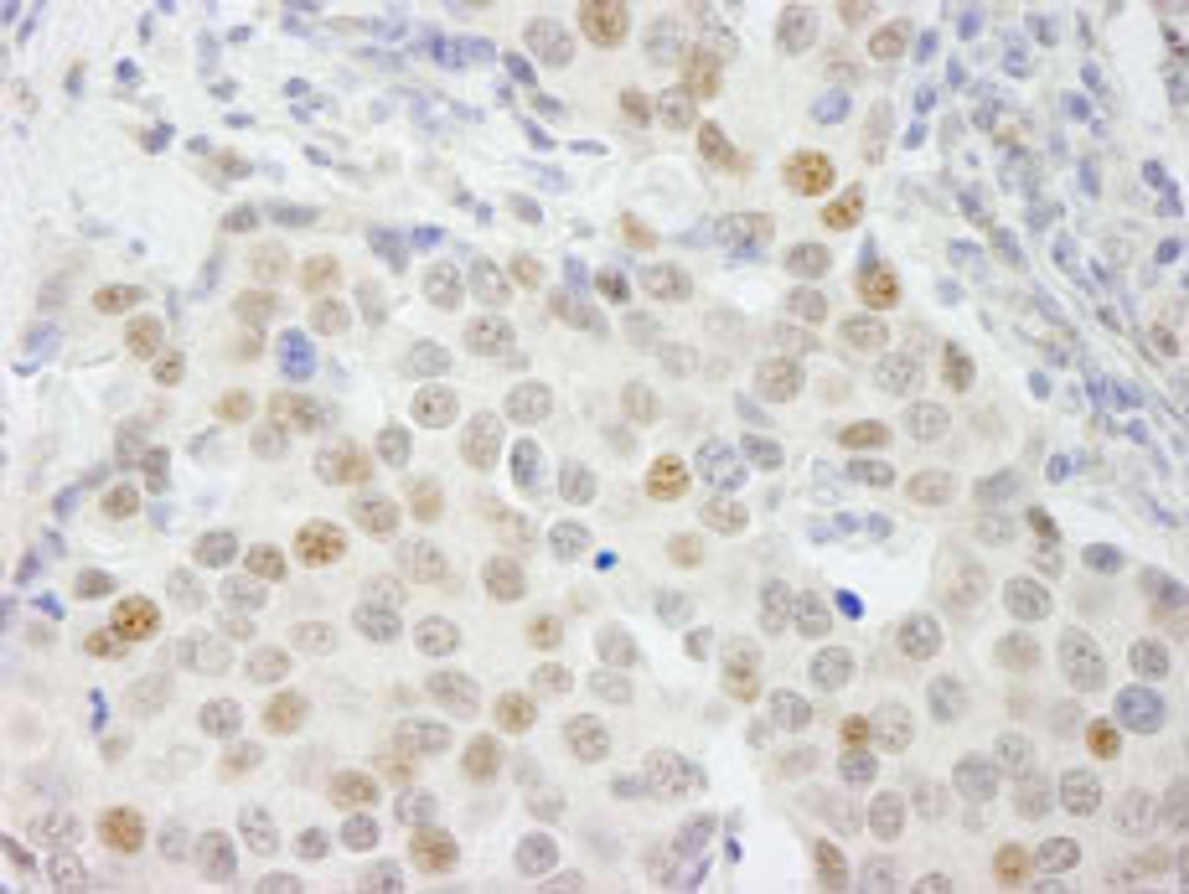 Detection of human GTF3C4/TFIIIC90 by immunohistochemistry.