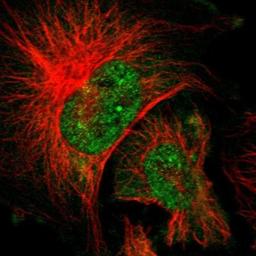 Immunocytochemistry/Immunofluorescence: Aldolase C Antibody [NBP1-90954] - Staining of human cell line U-251 MG shows positivity in nucleus, nucleoli & cytoplasm.