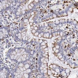 Immunohistochemistry-Paraffin: Galactosidase alpha Antibody [NBP1-89796] - Staining of human small intestine shows strong cytoplasmic positivity in glandular cells.