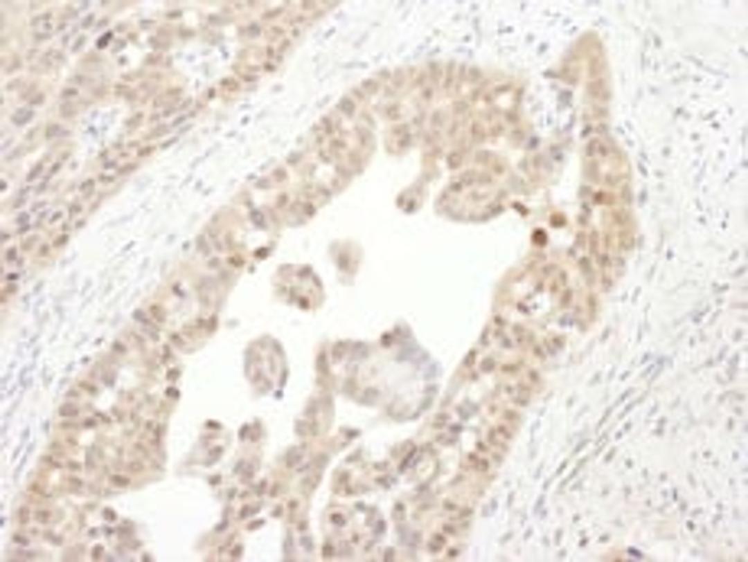 Detection of human PSMC4 by immunohistochemistry.