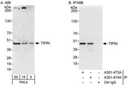 Detection of human TIPIN by western blot and immunoprecipitation.