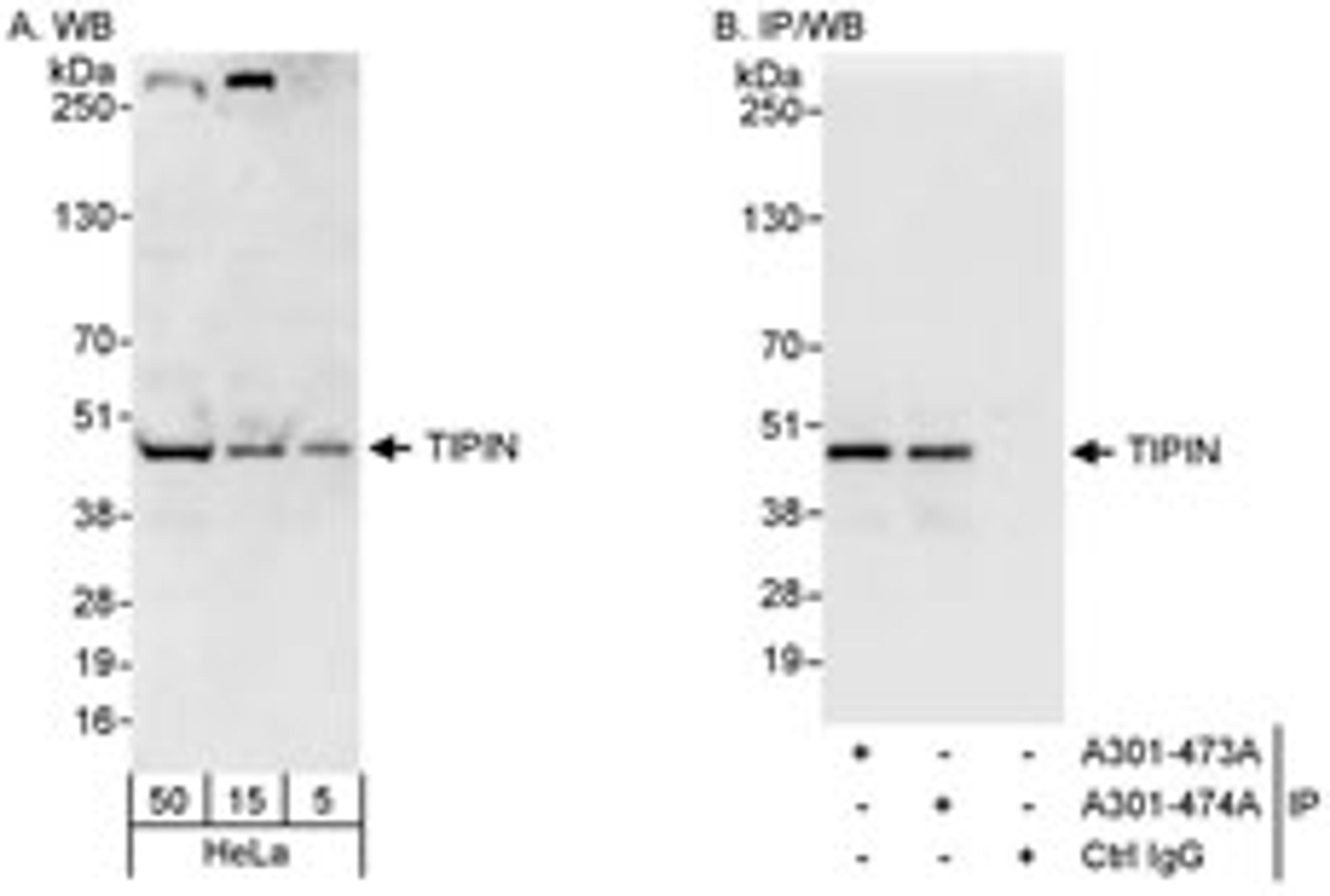 Detection of human TIPIN by western blot and immunoprecipitation.