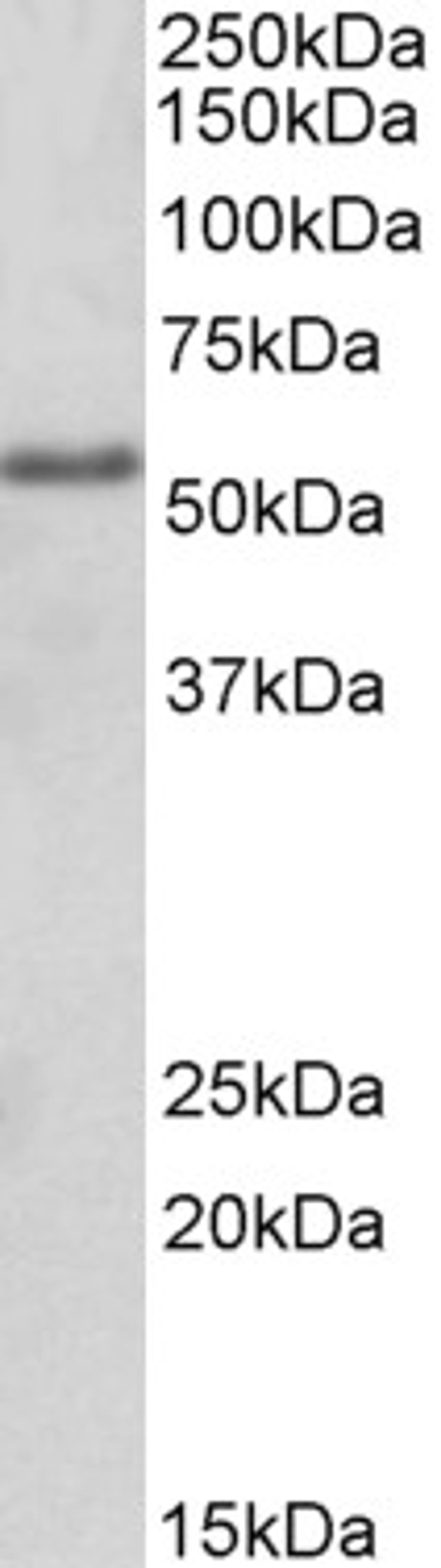 45-604 (2ug/ml) staining of HEK293 lysate (35ug protein in RIPA buffer). Primary incubation was 1 hour. Detected by chemiluminescence.