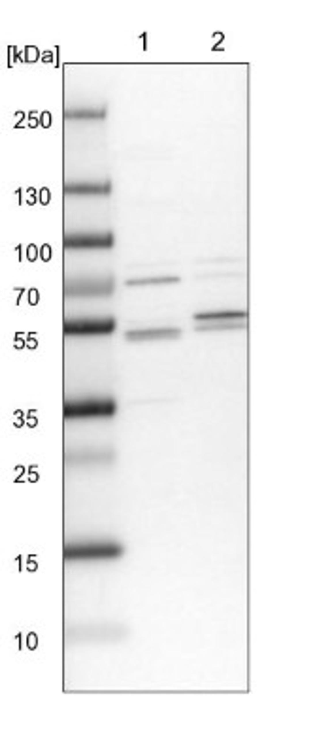 Western Blot: Kaptin Antibody [NBP1-92035] - Lane 1: NIH-3T3 cell lysate (Mouse embryonic fibroblast cells)<br/>Lane 2: NBT-II cell lysate (Rat Wistar bladder tumour cells)