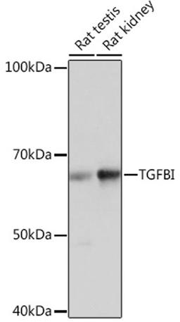 Western blot - TGFBI Rabbit mAb (A2407)