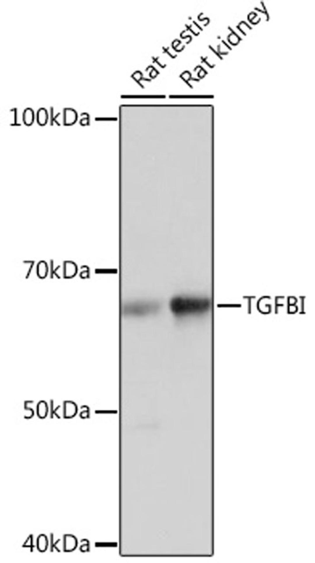 Western blot - TGFBI Rabbit mAb (A2407)