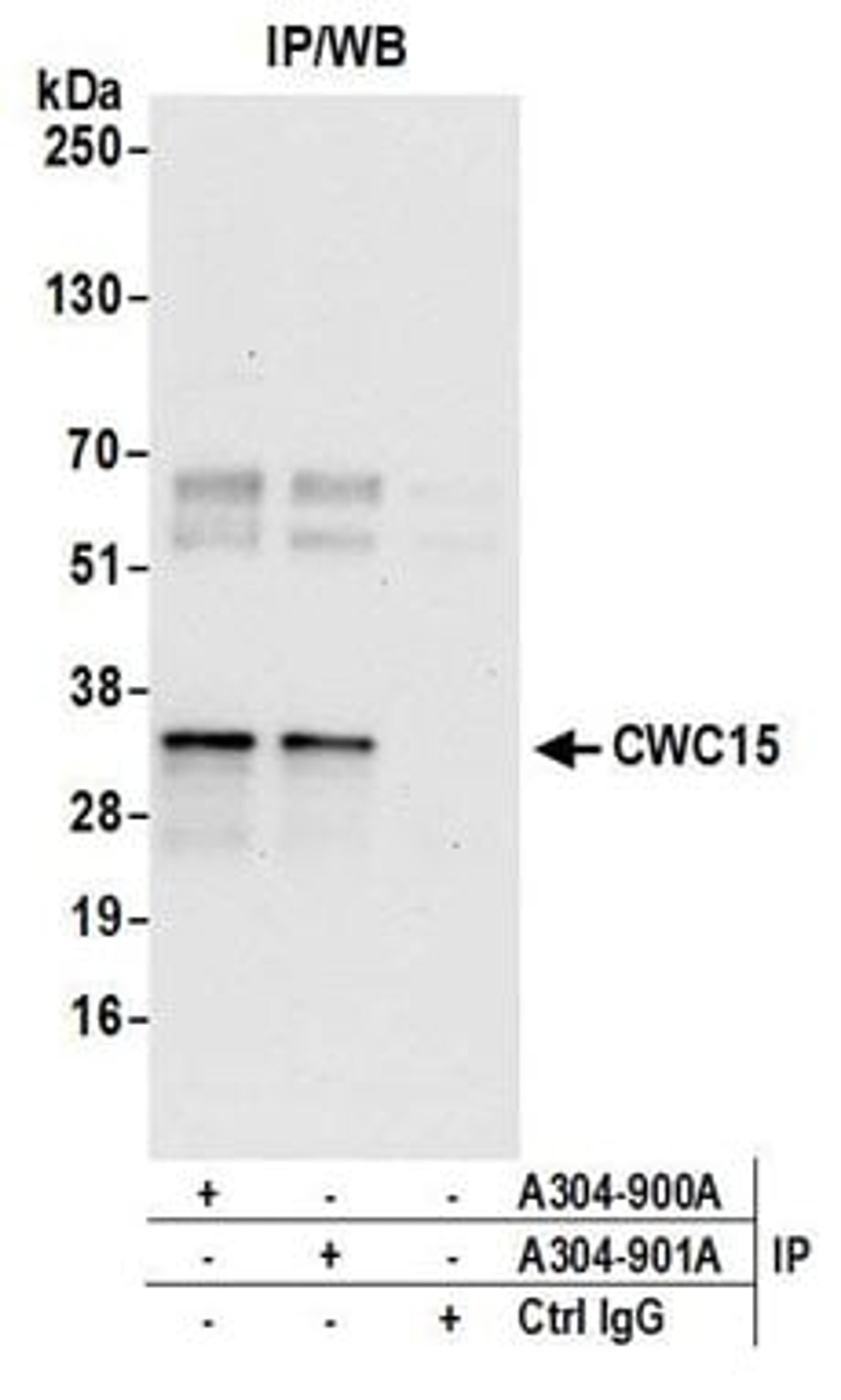 Detection of human CWC15 by western blot of immunoprecipitates.