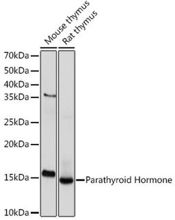 Western blot - Parathyroid Hormone Rabbit mAb (A9704)