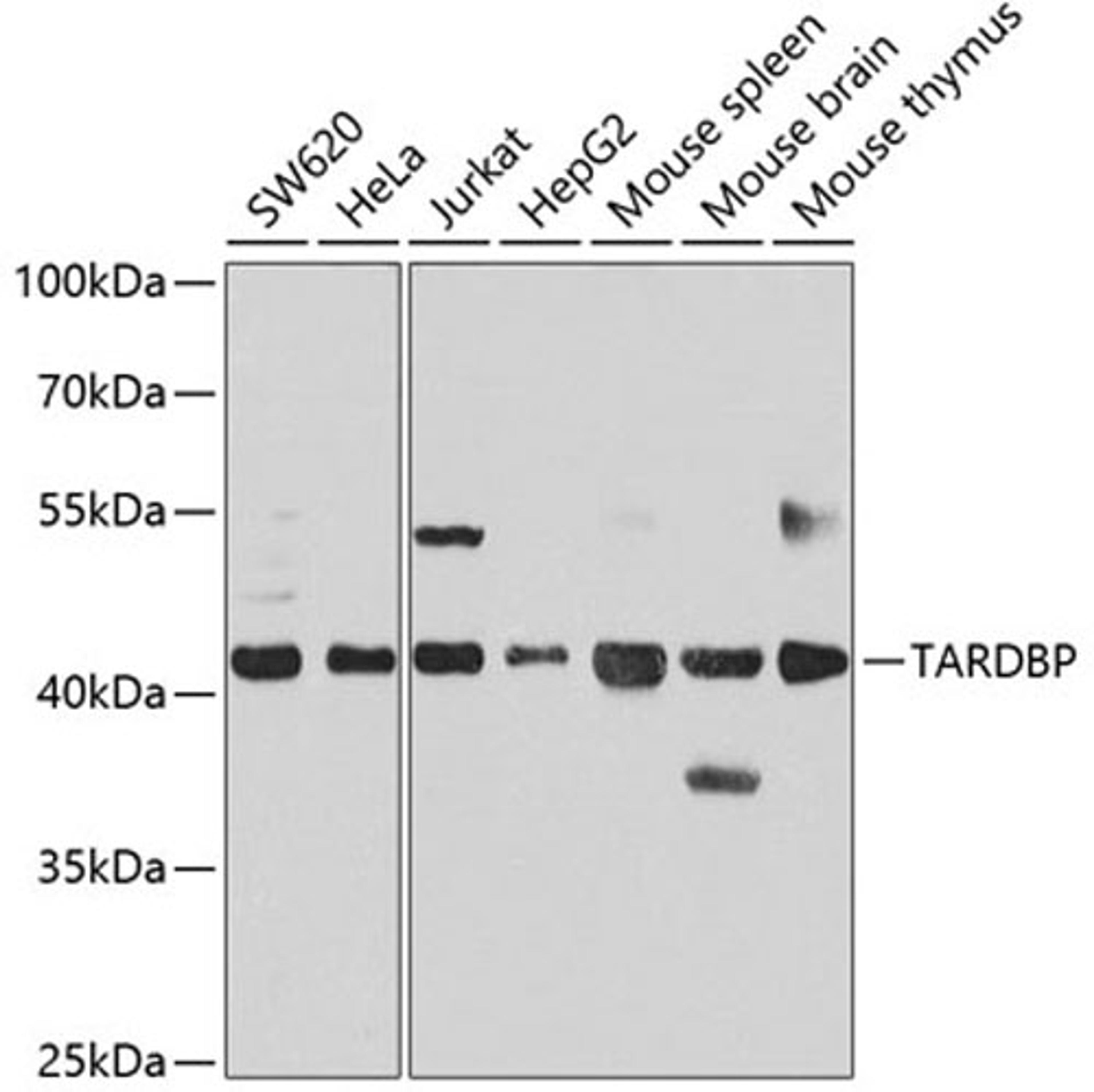 Western blot - TARDBP antibody (A13405)