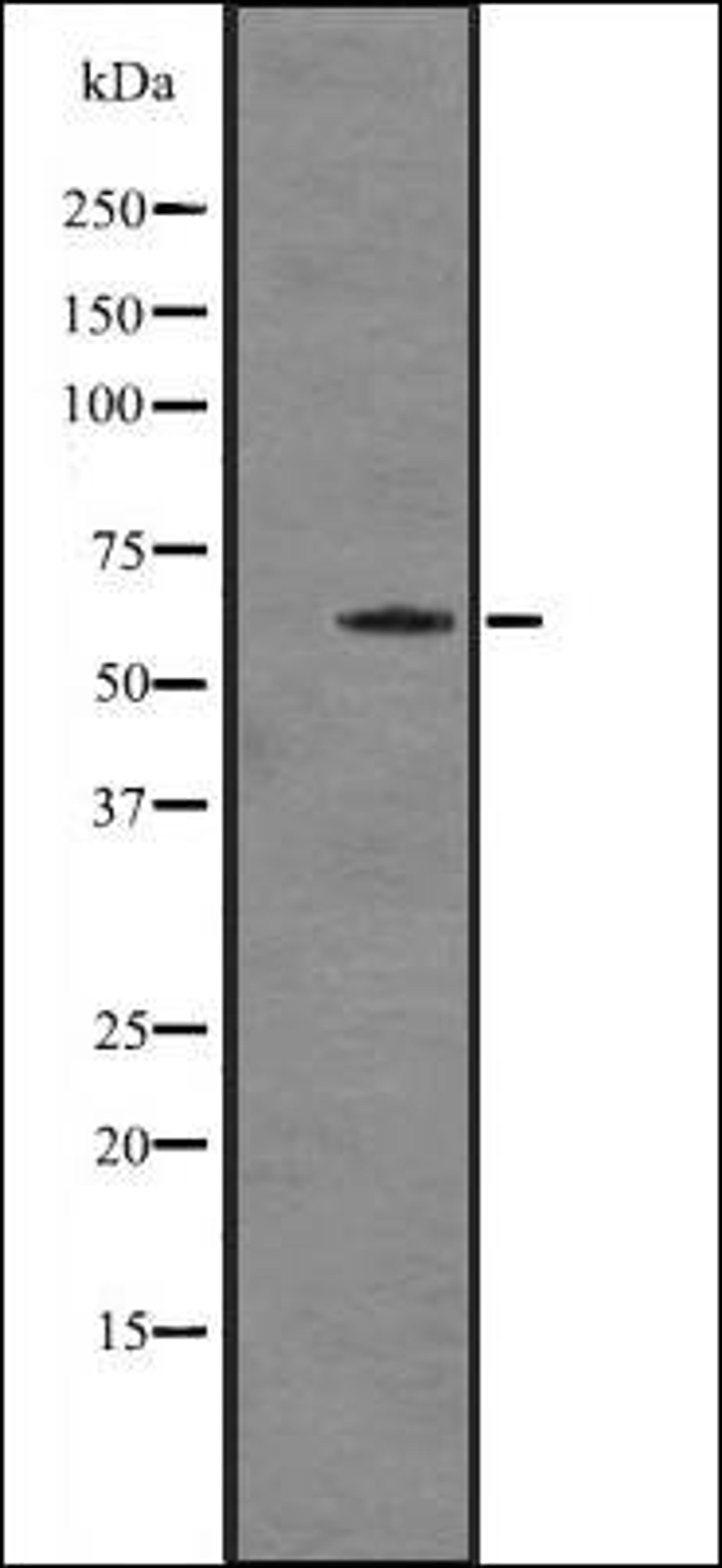 Western blot analysis of K562 cell lysates using Cytochrome P450 7A1 antibody