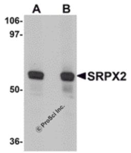 Western blot analysis of SRPX2 in human lung tissue lysate with SRPX2 antibody at (A) 1 and (B) 2 μg/mL.