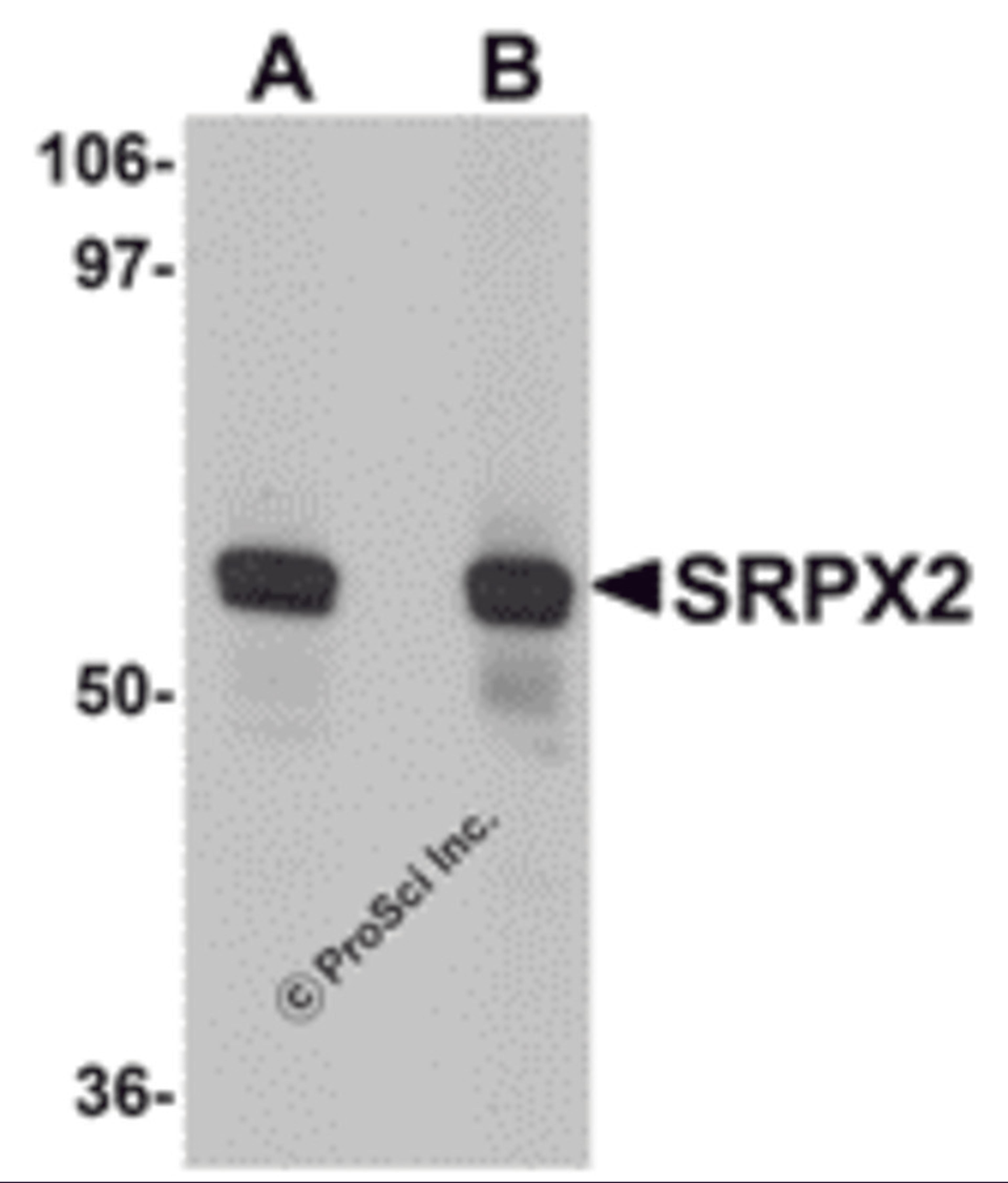 Western blot analysis of SRPX2 in human lung tissue lysate with SRPX2 antibody at (A) 1 and (B) 2 μg/mL.