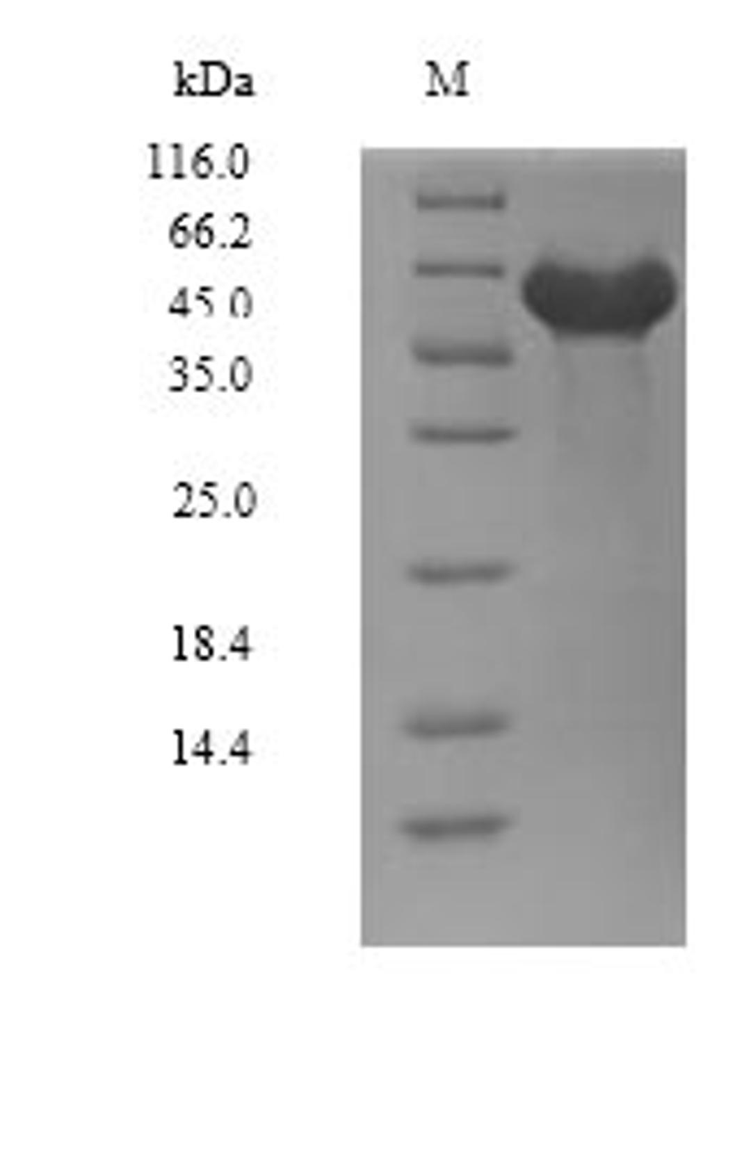 (Tris-Glycine gel) Discontinuous SDS-PAGE (reduced) with 5% enrichment gel and 15% separation gel.