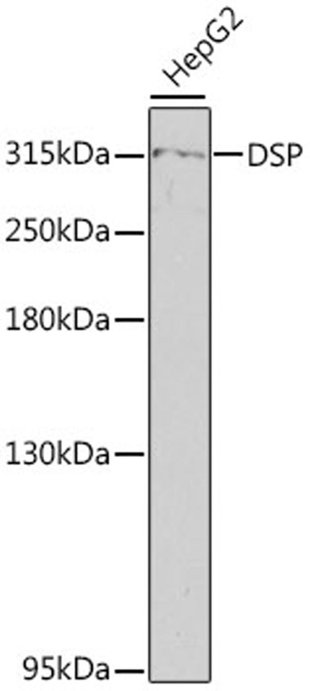 Western blot - Desmoplakin antibody (A13299)