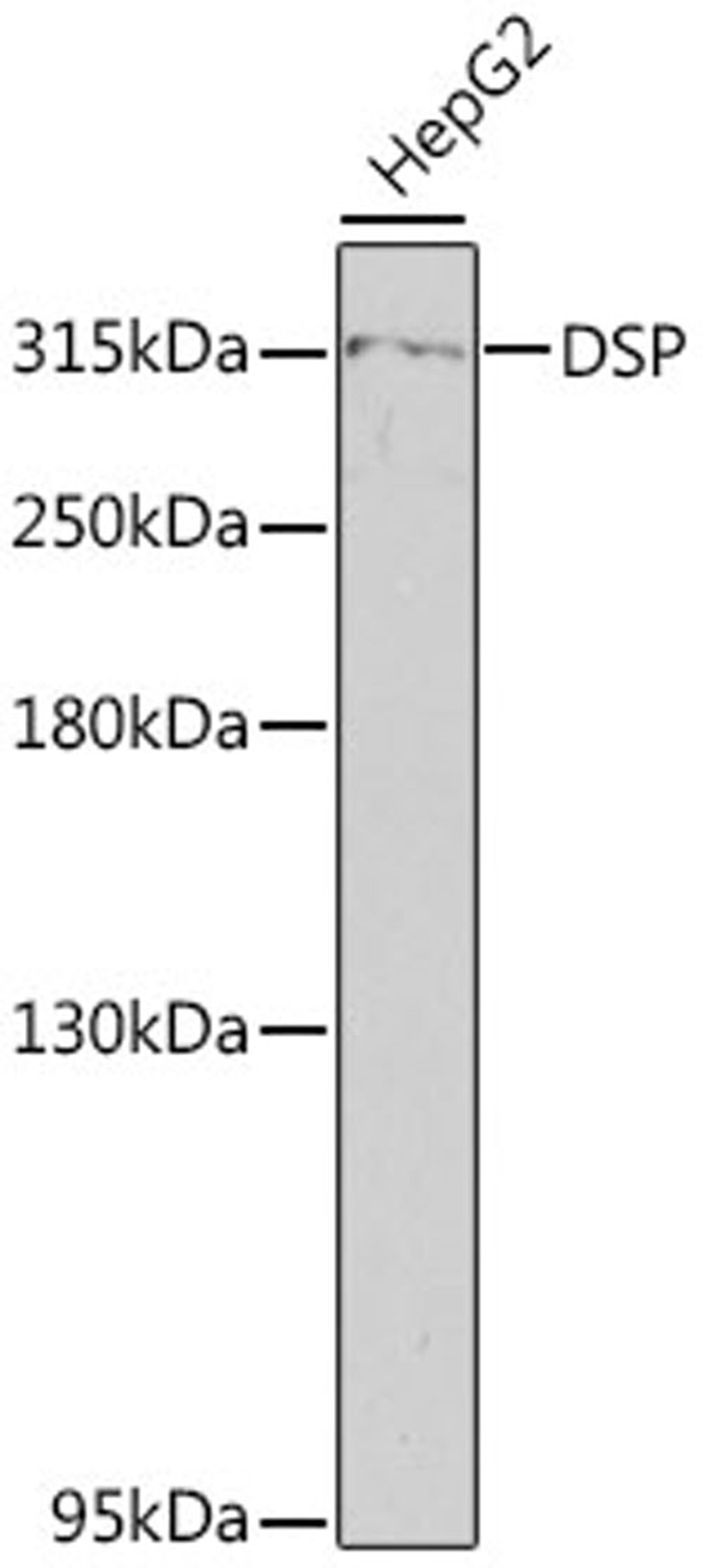 Western blot - Desmoplakin antibody (A13299)