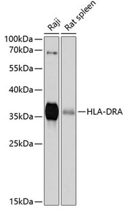 Western blot - HLA-DRA antibody (A11787)