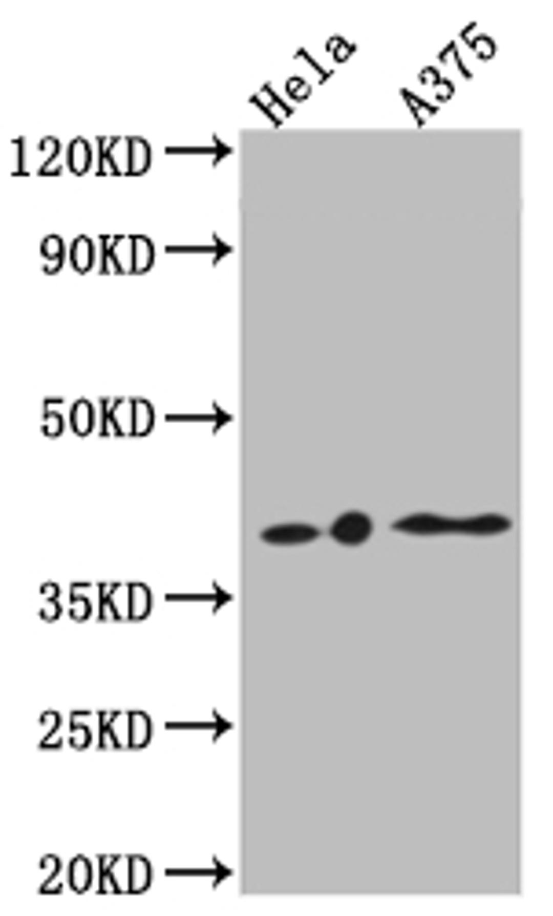 Western Blot. Positive WB detected in: Hela whole cell lysate, A375 whole cell lysate. All lanes: EDG2 antibody at 1:1000. Secondary. Goat polyclonal to rabbit IgG at 1/50000 dilution. Predicted band size: 42, 42 kDa. Observed band size: 42 kDa. 