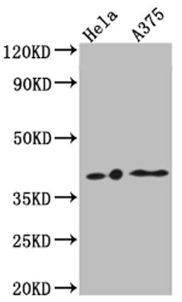 Western Blot. Positive WB detected in: Hela whole cell lysate, A375 whole cell lysate. All lanes: EDG2 antibody at 1:1000. Secondary. Goat polyclonal to rabbit IgG at 1/50000 dilution. Predicted band size: 42, 42 kDa. Observed band size: 42 kDa. 