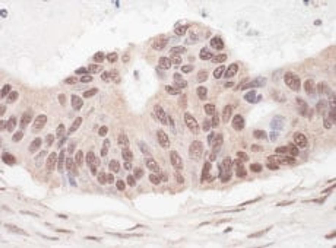 Detection of human L3MBTL2 by immunohistochemistry.