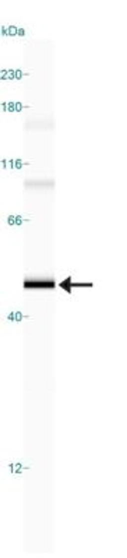 Simple Western: CRHR2/CRF2 Antibody [NB100-56485] - Simple Western lane view shows a specific band for Corticotropin Releasing Factor 2 in 0.5 mg/ml of Human Brain lysate.  This experiment was performed under reducing conditions using the 12-230 kDa separation system.