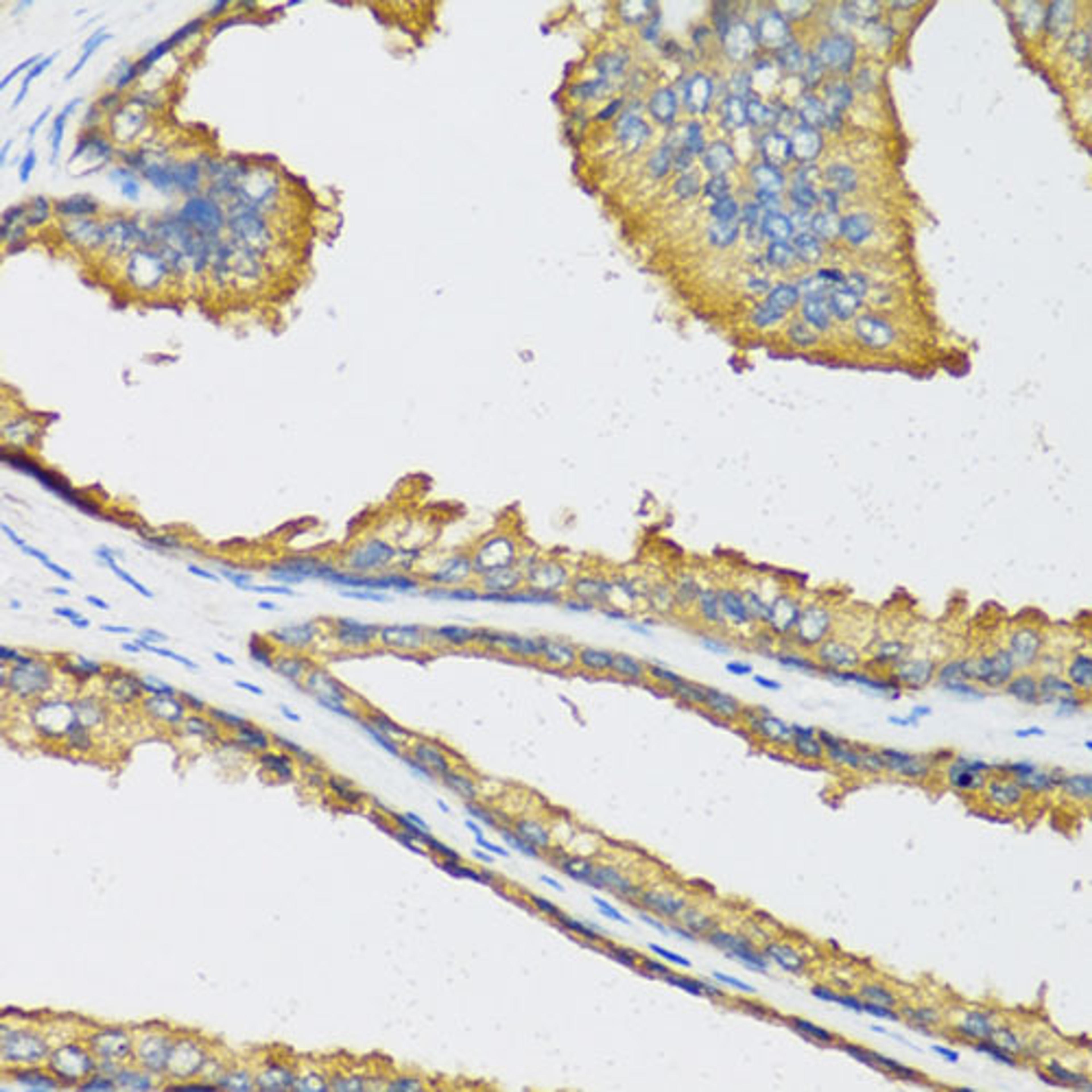 Immunohistochemistry  - CXCL11 antibody (A6201)