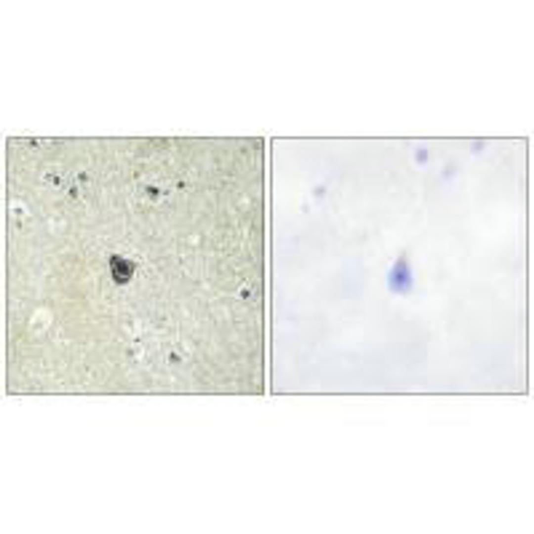 Immunohistochemistry analysis of paraffin-embedded human brain tissue using CSFR (Ab-809) antibody.