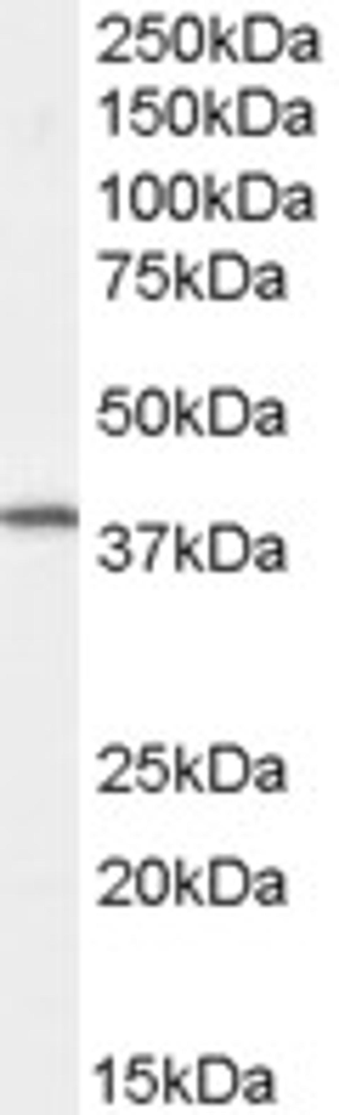 45-510 staining (0.5ug/ml) of Human Spleen lysate (RIPA buffer, 30ug total protein per lane). Primary incubated for 1 hour. Detected by chemiluminescence.