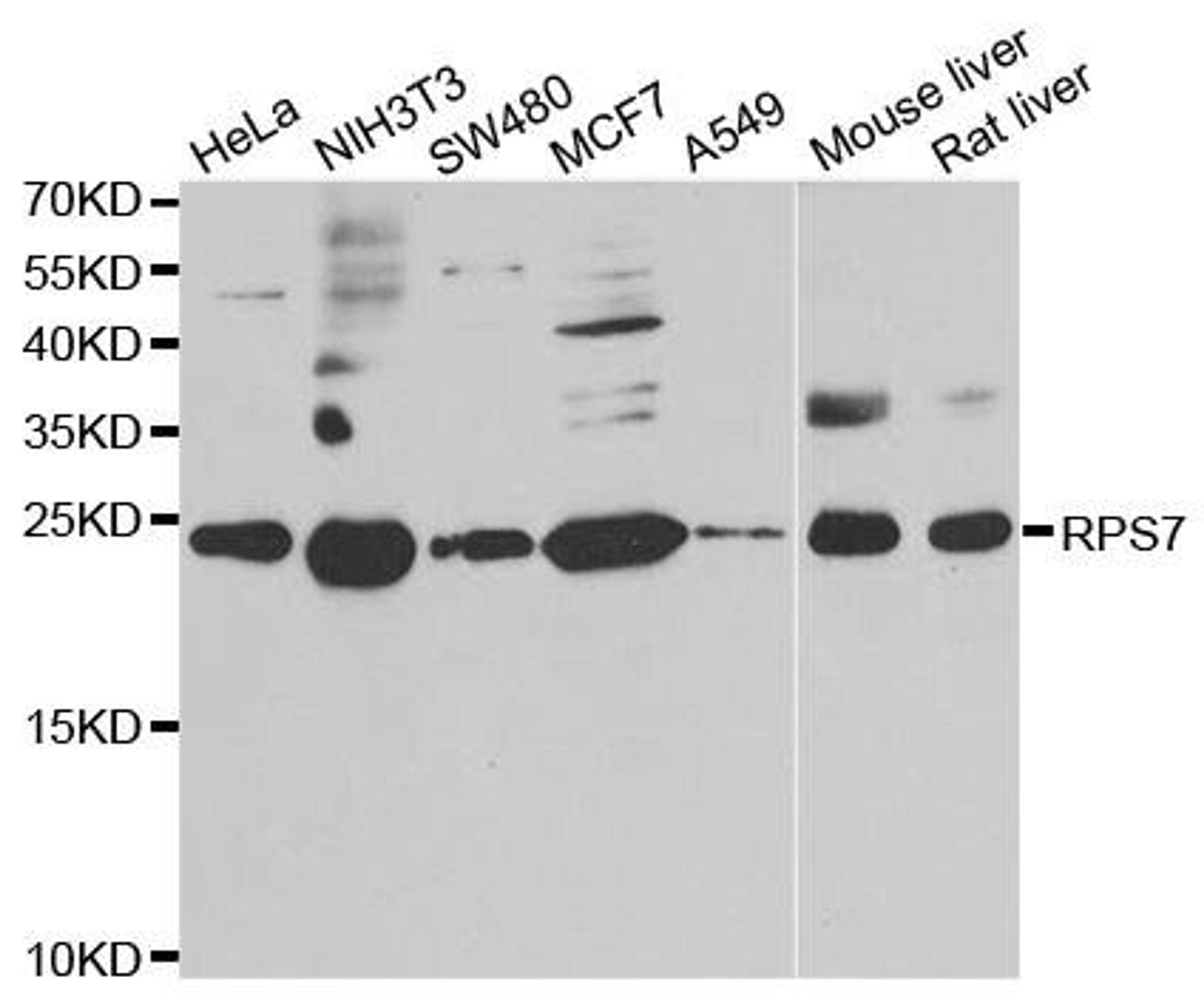 Western blot analysis of extracts of various cell lines using RPS7 antibody