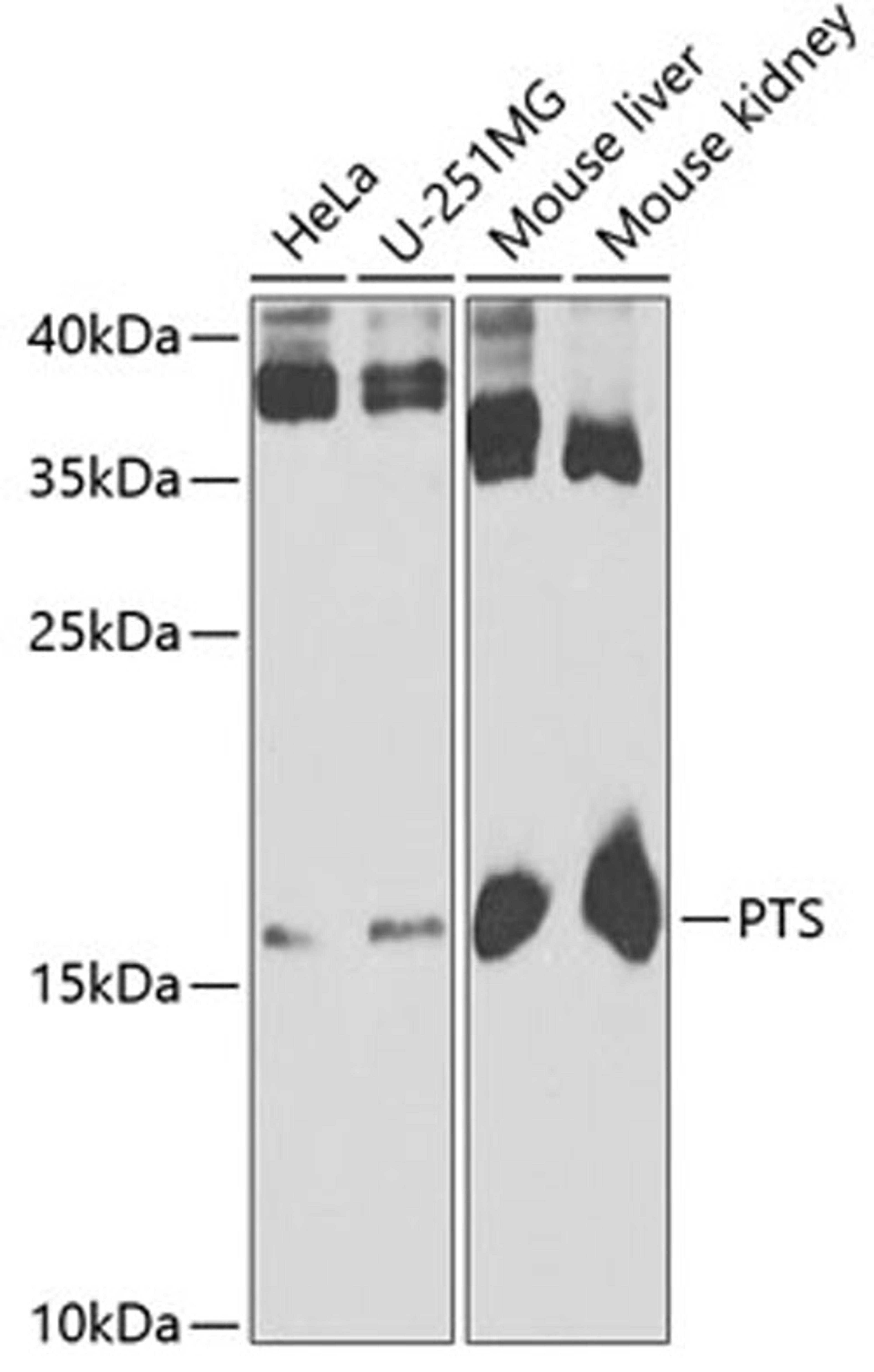 Western blot - PTS antibody (A6306)