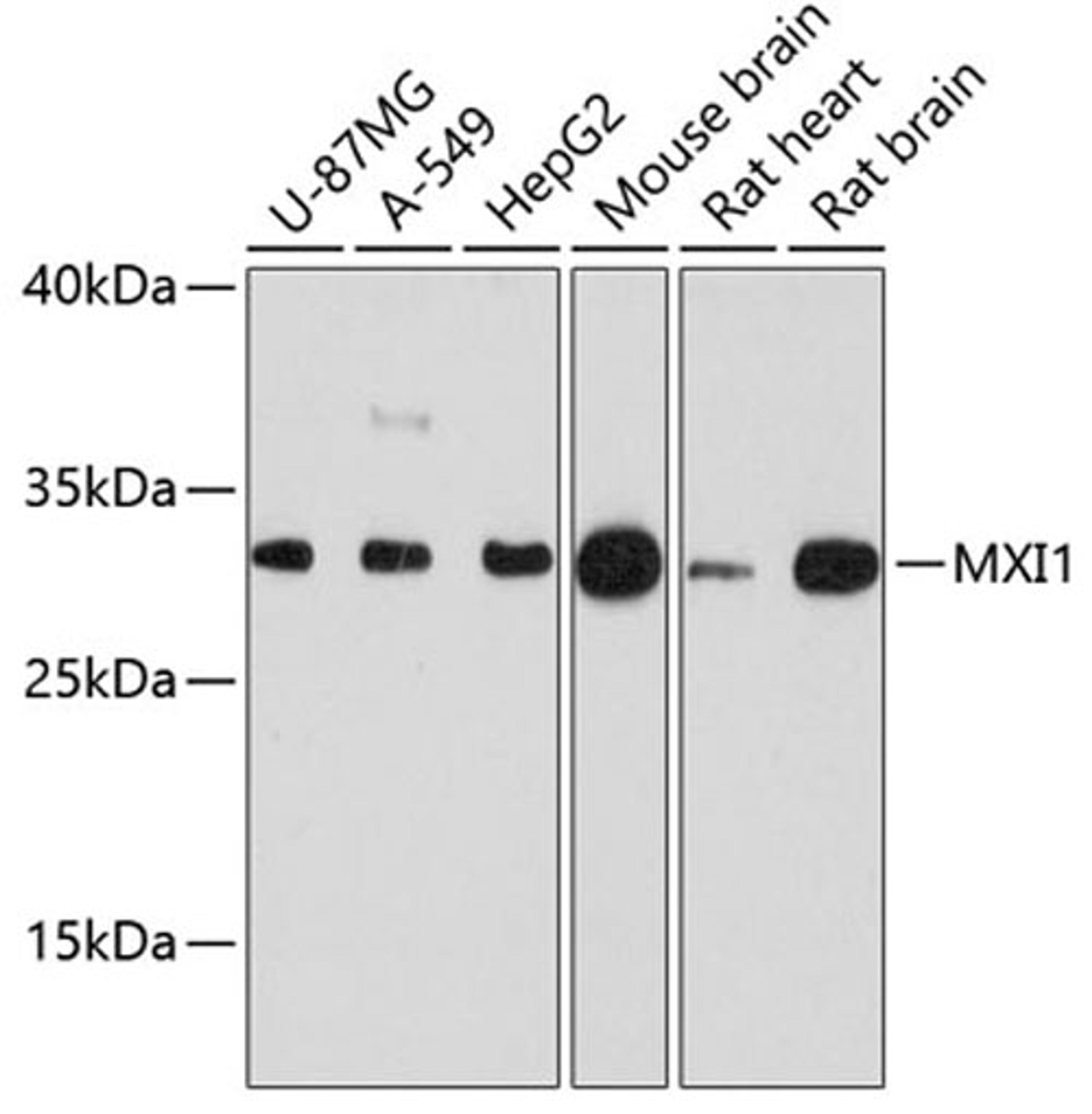 Western blot - MXI1 antibody (A12098)