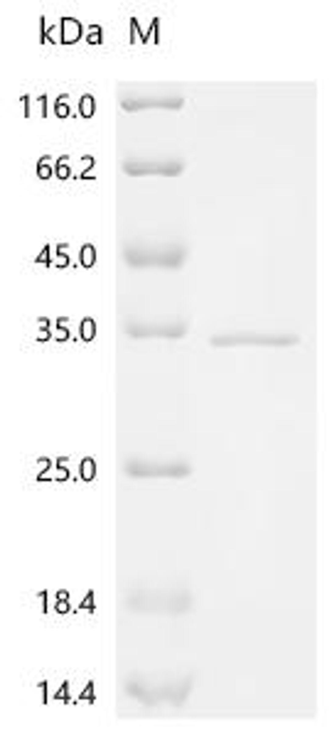 (Tris-Glycine gel) Discontinuous SDS-PAGE (reduced) with 5% enrichment gel and 15% separation gel.