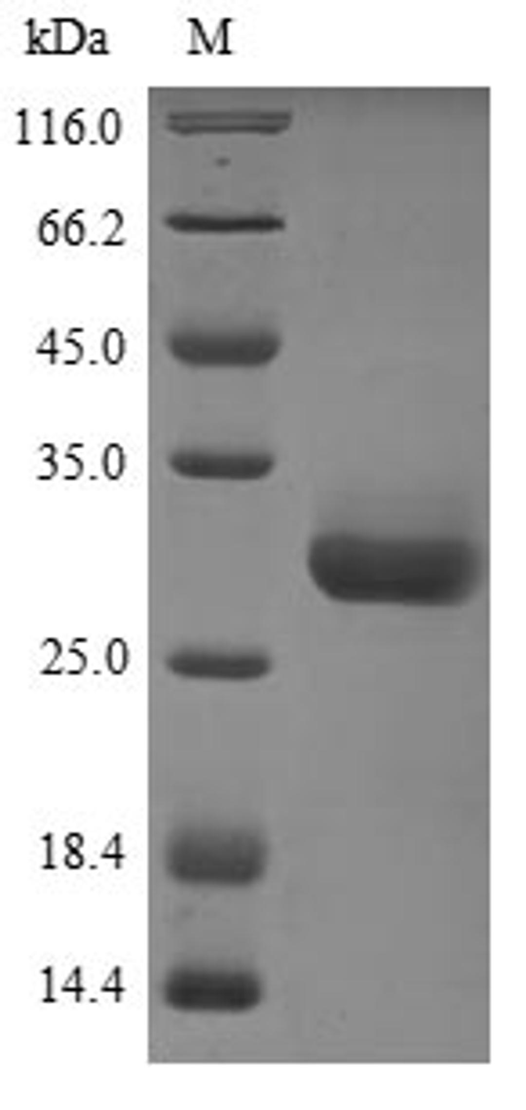 (Tris-Glycine gel) Discontinuous SDS-PAGE (reduced) with 5% enrichment gel and 15% separation gel.