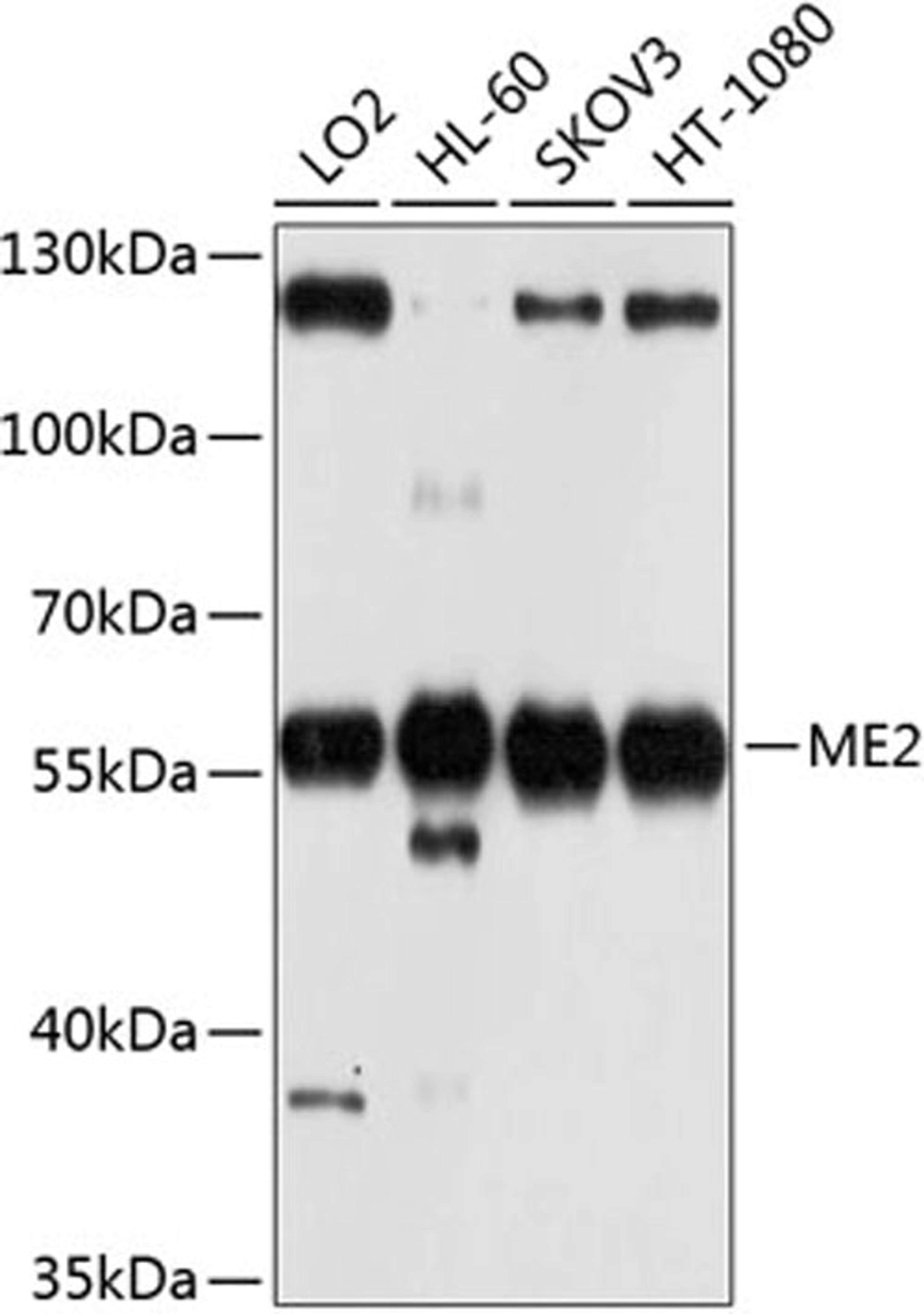 Western blot - ME2 antibody (A9650)