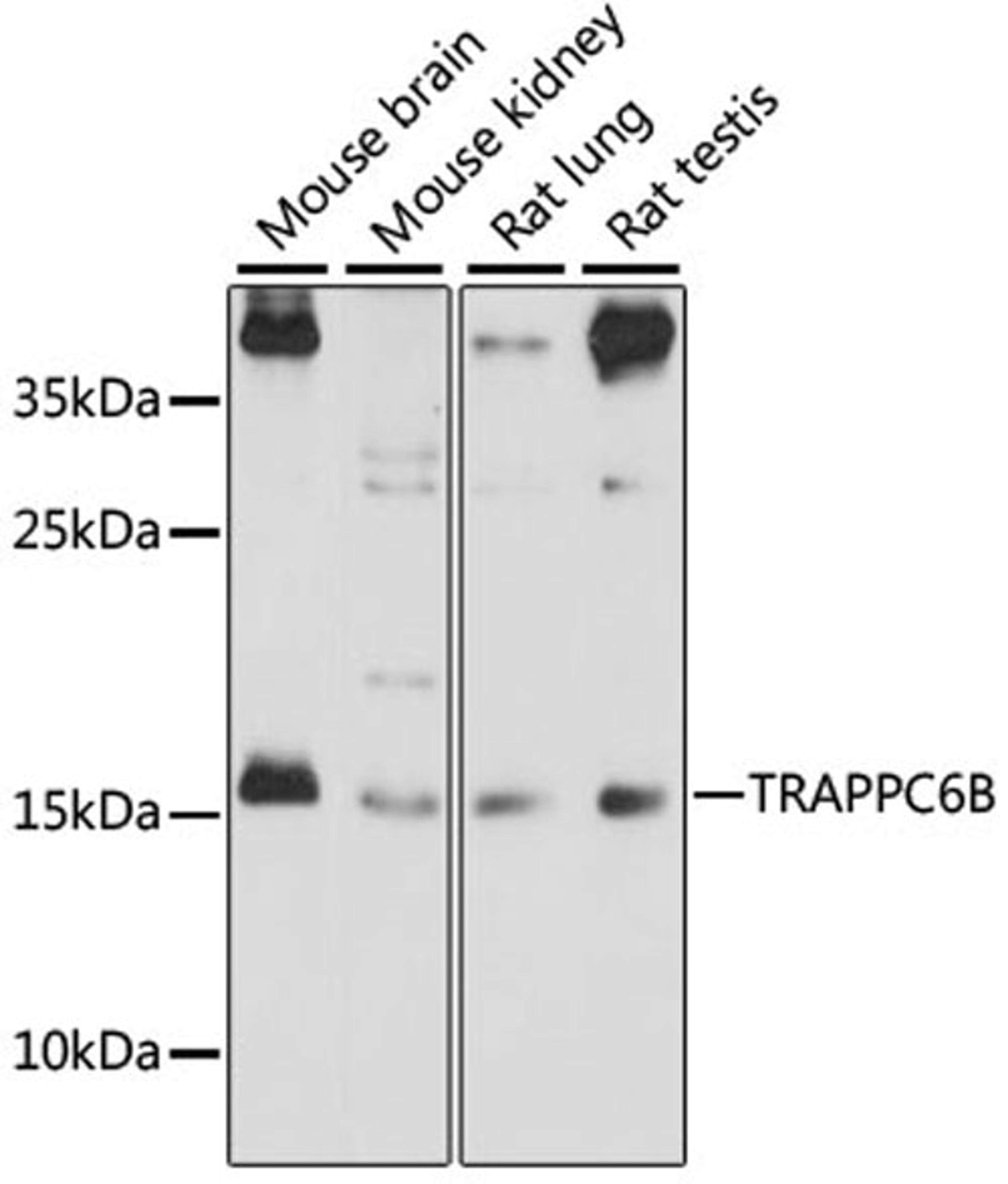 Western blot - TRAPPC6B antibody (A15561)