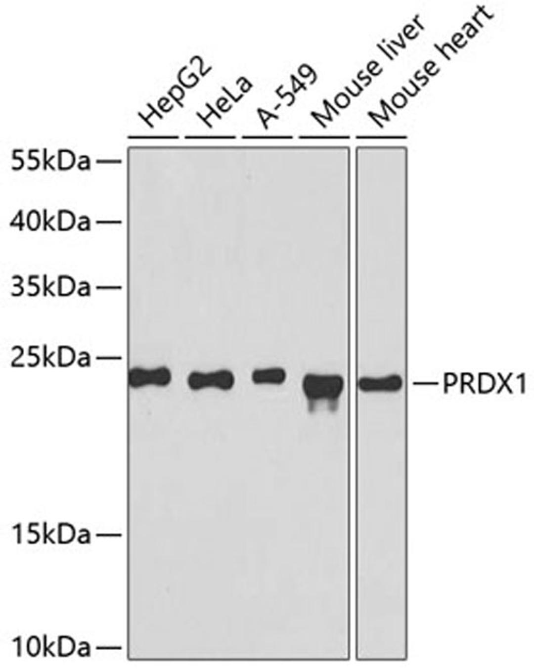 Western blot - PRDX1 antibody (A1842)