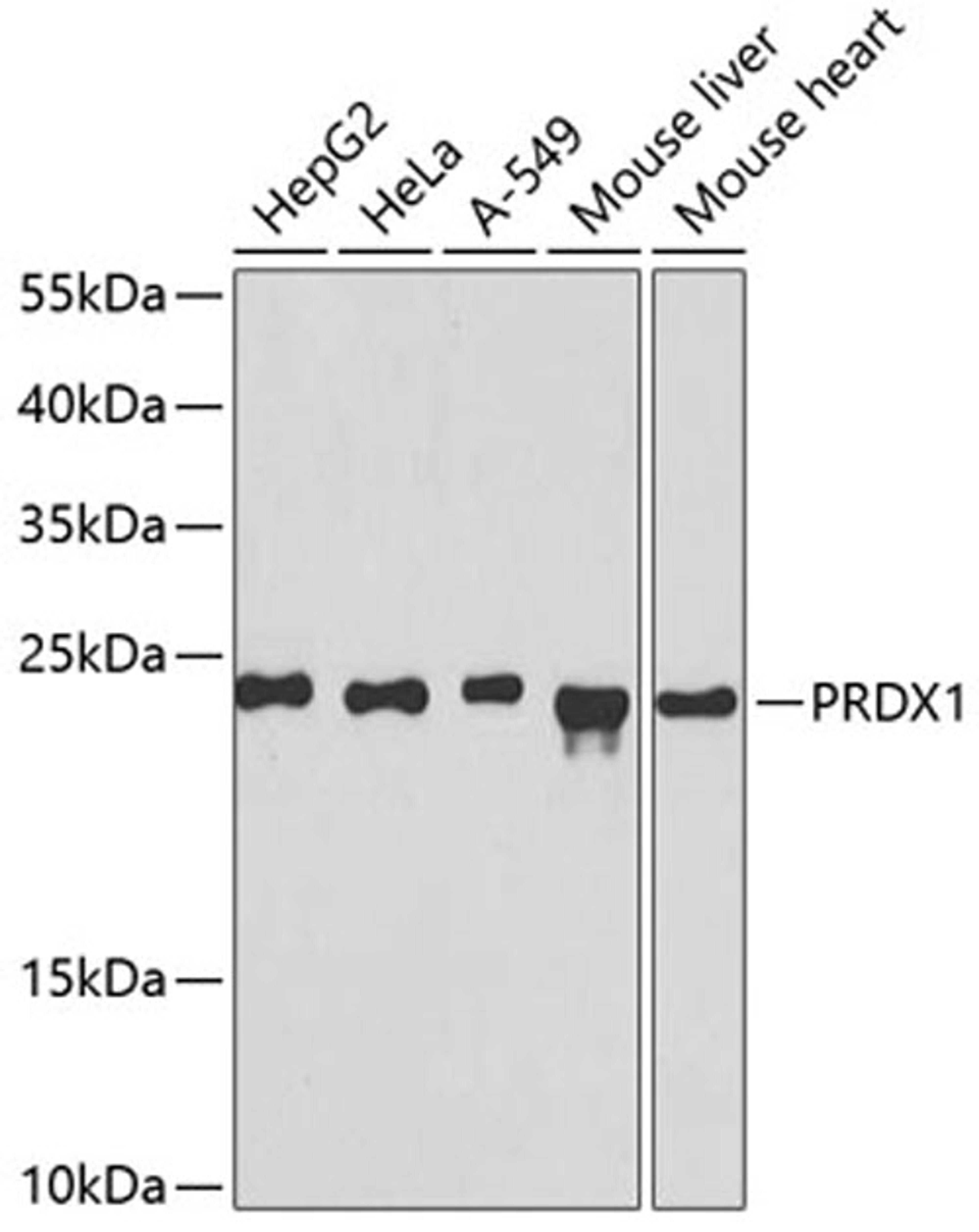 Western blot - PRDX1 antibody (A1842)