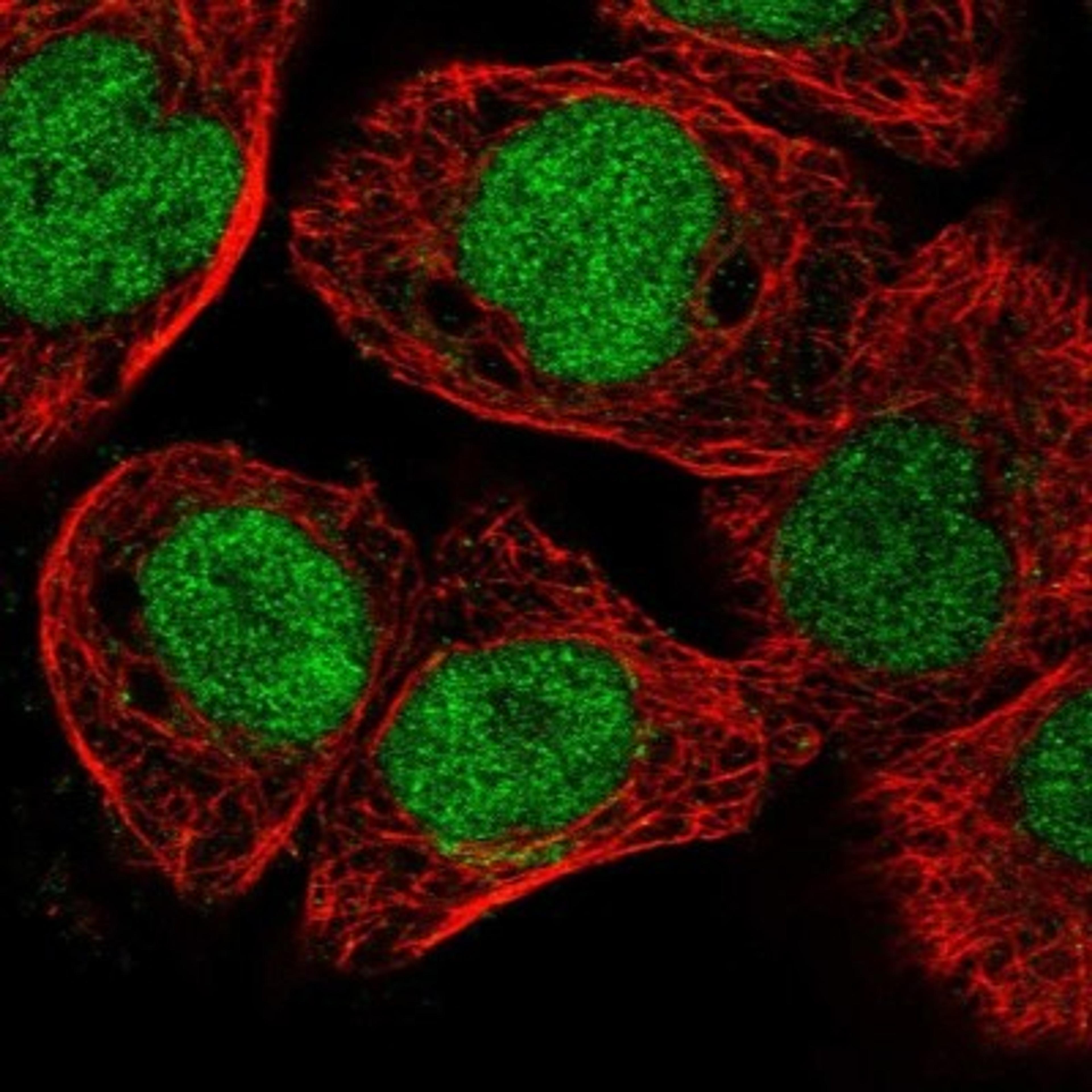 Immunocytochemistry/Immunofluorescence: ELAC2 Antibody [NBP1-84620] - Staining of human cell line A-431 shows positivity in nucleus but not nucleoli.