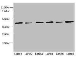 Western blot. All lanes: TMOD1 antibody at 1.85ug/ml. Lane 1: Mouse brain tissue. Lane 2: Mouse lung tissue. Lane 3: Hela whole cell lysate. Lane 4: K562 whole cell lysate. Lane 5: A549 whole cell lysate. Lane 6: MCF-7 whole cell lysate. Secondary. Goat polyclonal to rabbit IgG at 1/10000 dilution. Predicted band size: 41, 27 kDa. Observed band size: 41 kDa. 