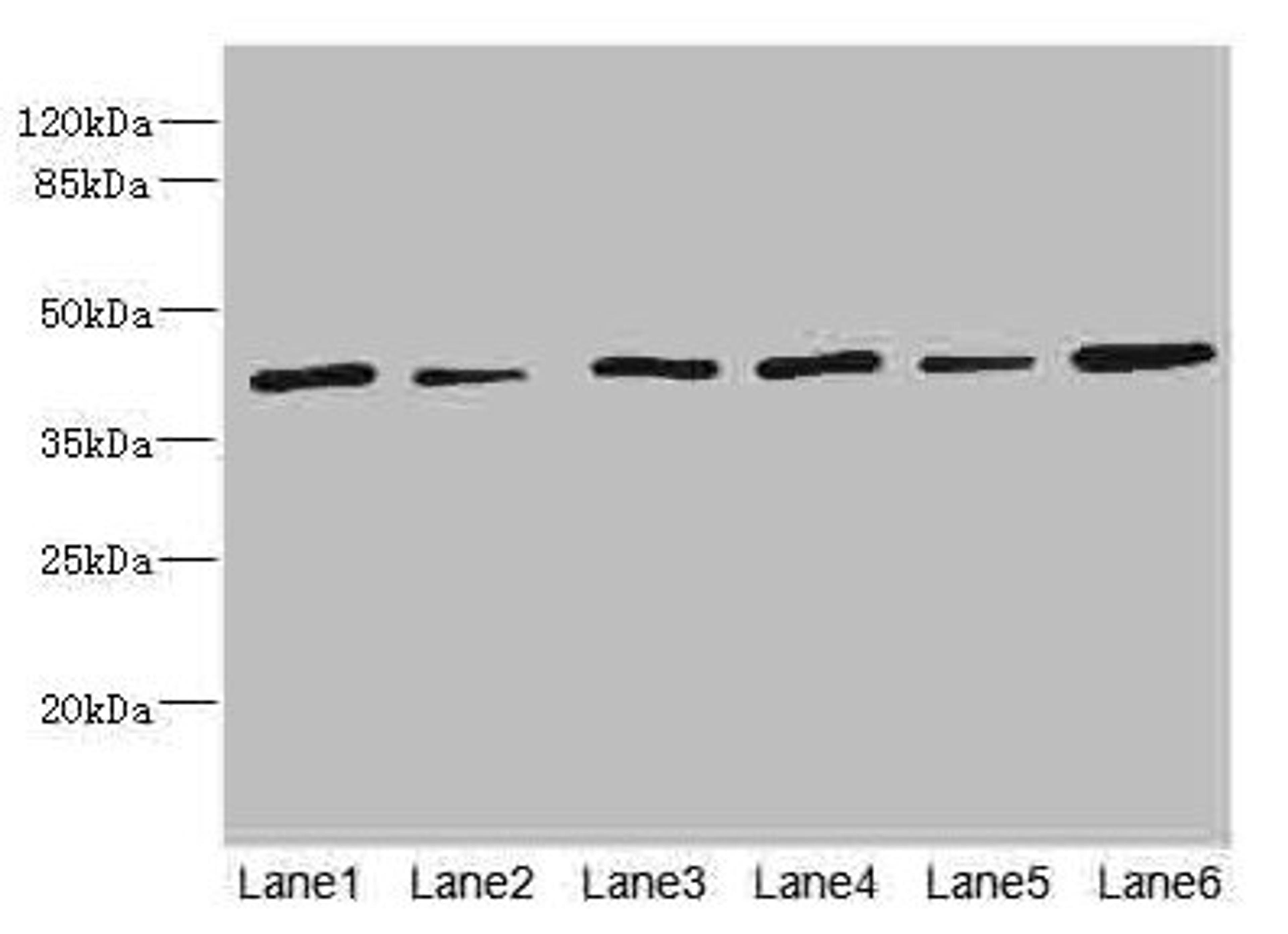 Western blot. All lanes: TMOD1 antibody at 1.85ug/ml. Lane 1: Mouse brain tissue. Lane 2: Mouse lung tissue. Lane 3: Hela whole cell lysate. Lane 4: K562 whole cell lysate. Lane 5: A549 whole cell lysate. Lane 6: MCF-7 whole cell lysate. Secondary. Goat polyclonal to rabbit IgG at 1/10000 dilution. Predicted band size: 41, 27 kDa. Observed band size: 41 kDa. 
